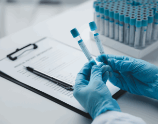 test tubes