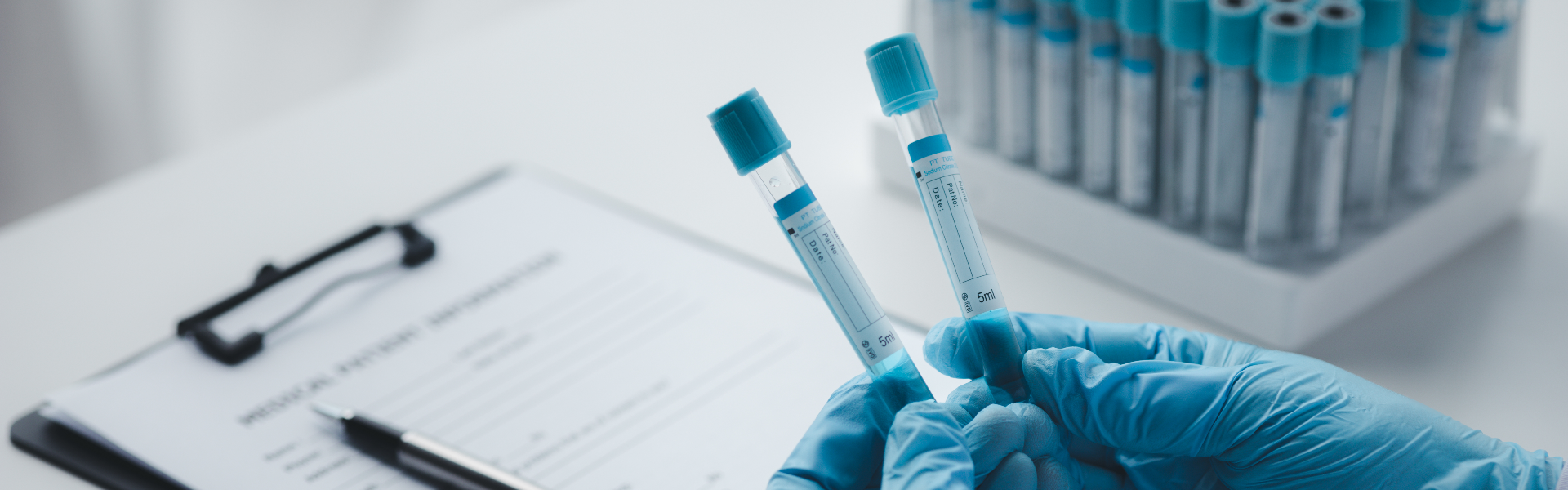 test tubes