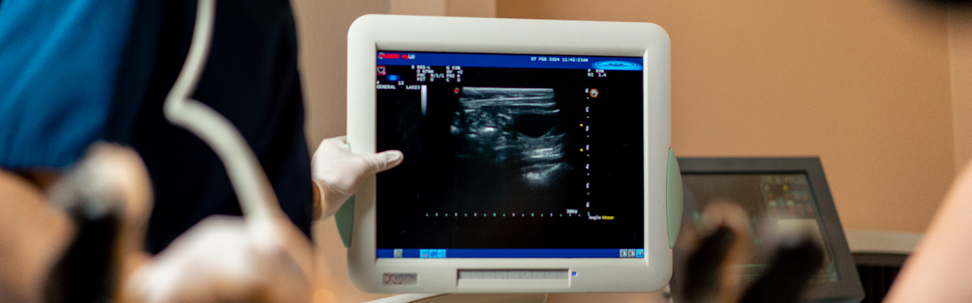 display on monitor