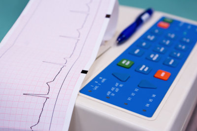 Electrocardiogram